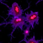 macrophage-upp1-mtros-cgas-nlrp3-axis-drives-lung-cancer-metastasis