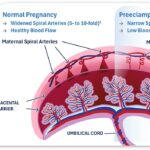 klk1-expands-possibilities-to-restore-vascular-health