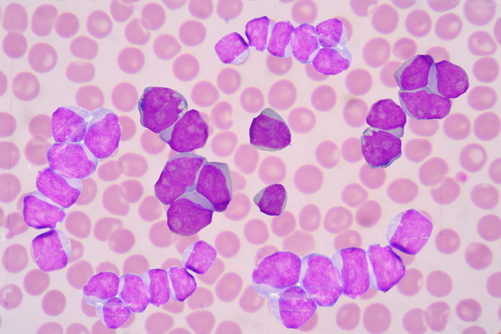 epigenomic-analysis-uncovers-new-aml-subgroups-and-drug-sensitivities