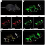 fmr1-gene-therapy-rescues-fragile-x-syndrome-traits-in-mice