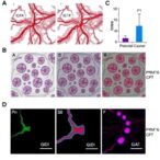 prmt6-promotes-blood-vessel-growth-in-colorectal-cancer