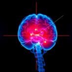 kaist-creates-ai-to-detect-early-cerebrovascular-disease-signs-at-home