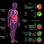 anthropometric-traits-and-metabolic-biomarkers-linked-to-pancreatic-cancer-risk