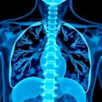 years-algorithm-enhances-pulmonary-embolism-diagnosis-in-cancer-patients