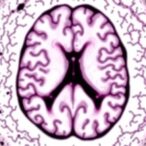 clinicopathologic-study-reveals-amyloid-clearance-in-alzheimer’s-disease