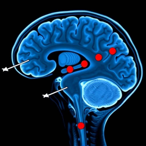 deep-learning-detects-rem-sleep-disorder-and-parkinson’s-early-via-fmri