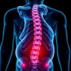 osteoclasts-trigger-dcc-loop-causing-chronic-low-back-pain-in-mice