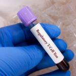 cellares-and-sonoma-biotherapeutics-agree-to-automate-engineered-treg-cell-therapy-manufacturing