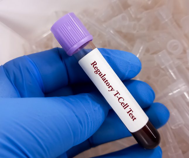 cellares-and-sonoma-biotherapeutics-agree-to-automate-engineered-treg-cell-therapy-manufacturing