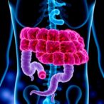 nebraska-study-links-gut-microbe-to-cancer-fighting-immune-response
