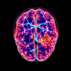 imaging-study-finds-widespread-brain-connectivity-loss-in-schizophrenia