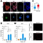 correction:-positive-tkt–c-myc-loop-promotes-tace-resistance-in-hepatocellular-carcinoma