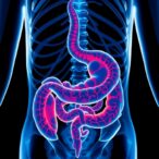 study-links-early-pfas-exposure-to-childhood-intestinal-inflammation-at-mount-sinai