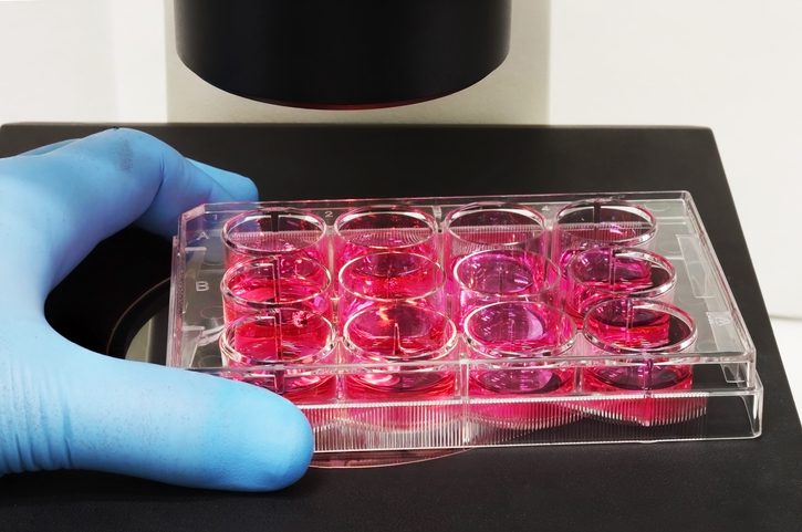 autolomous-and-cellular-origins-expand-cell-therapy-manufacturing-process