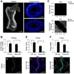 kpna2-overexpression-worsens-t4-colorectal-cancer-prognosis-by-nuclear-c-myc-suppression-of-p21