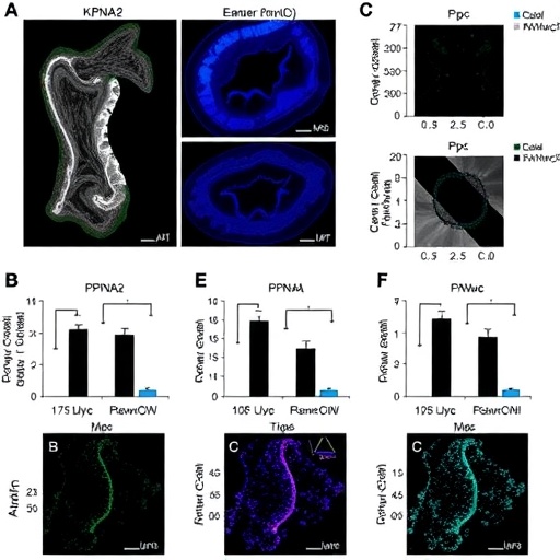 kpna2-overexpression-worsens-t4-colorectal-cancer-prognosis-by-nuclear-c-myc-suppression-of-p21