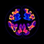 journal-of-nuclear-medicine-releases-ahead-of-print-update-for-july-17,-2026