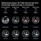 randomized-phase-ii-trial-tests-nivolumab-then-nivolumab-ipilimumab-or-docetaxel