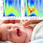 noninvasive-acoustic-assessment-of-feeding-skills-in-preterm-infants-with-bpd