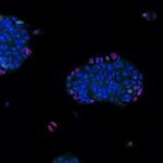 patient-derived-tumor-organoids-show-promise-for-personalizing-cancer-treatment