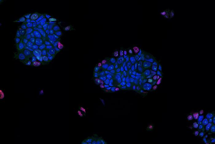 patient-derived-tumor-organoids-show-promise-for-personalizing-cancer-treatment