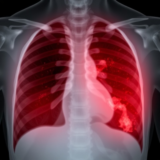 recurrent-pleural-effusion-case-highlights-diagnostic-challenge-between-tb-and-other-causes