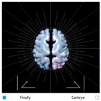real-time-decoding-of-human-emotion-states-using-integrated-gray-and-white-matter-signals