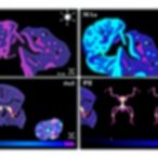 pathology-cot-trains-visual-chain-of-thought-agents-using-expert-whole-slide-diagnoses