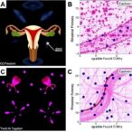 nonreproductive-tumor-progression-disrupts-ovarian-function-via-cxcl10–il18r1-signaling