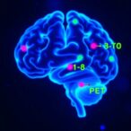 pet-ligand-enables-quantitative-imaging-of-brain-gene-expression
