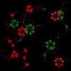 hk1–ldha-feedback-boosts-wnt5a-histone-lactylation,-linking-prenatal-acetaminophen-to-male-oa