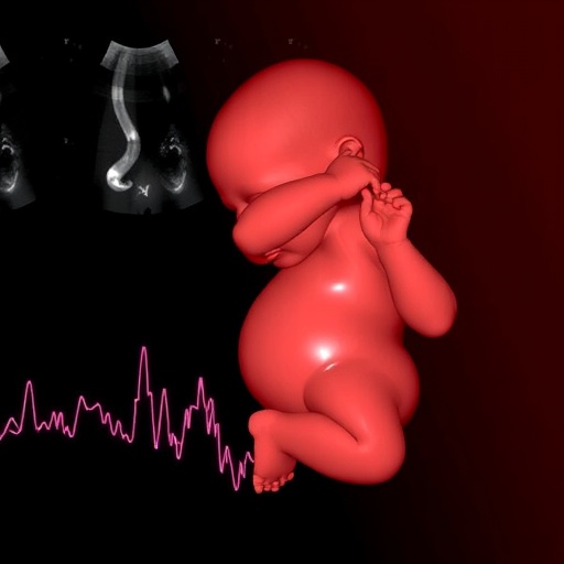 echocardiography-hemodynamics-in-preterm-infants-predict-neurodevelopment-through-age-three