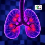 biguanide-derivative-4c-boosts-talazoparib-by-triggering-ferroptosis-in-bladder-cancer