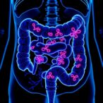 ai-predicts-bowel-cancer-relapse-risk-with-improved-accuracy