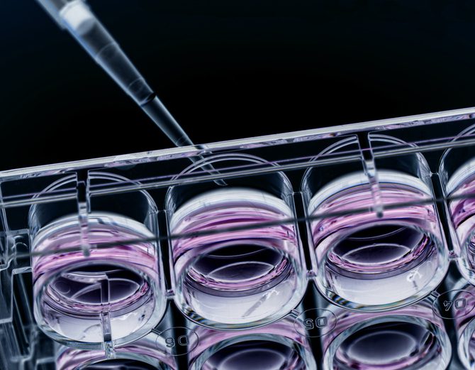 nova-biomedical-acquires-nanocellect-assets-to-expand-cell-line-development-portfolio