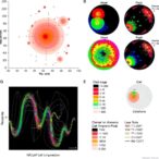 single-cell-profiling-of-nk/t-cell-lymphoma-uncovers-stratified-immune-states