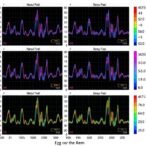 eeg-modeling-predicts-conversion-and-reveals-diverse-outcomes-in-isolated-rem-sleep-disorder