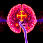 deadly-brain-tumors-show-vulnerability-to-new-sound-wave-approach