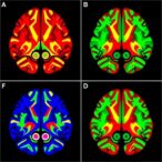 representations-of-the-intrinsic-value-of-information-in-mouse-orbitofrontal-cortex