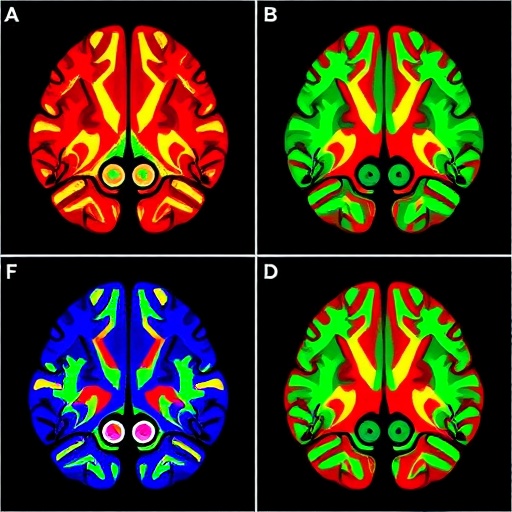 representations-of-the-intrinsic-value-of-information-in-mouse-orbitofrontal-cortex