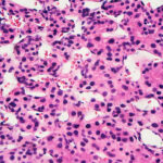 spatiotemporal-multiomics-charts-cellular-dynamics-of-liver-metastasis