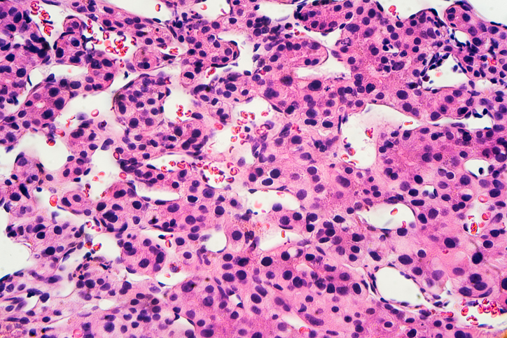 spatiotemporal-multiomics-charts-cellular-dynamics-of-liver-metastasis