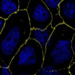 microbiota-derived-metabolite-enhances-hiv-therapy-in-monkeys