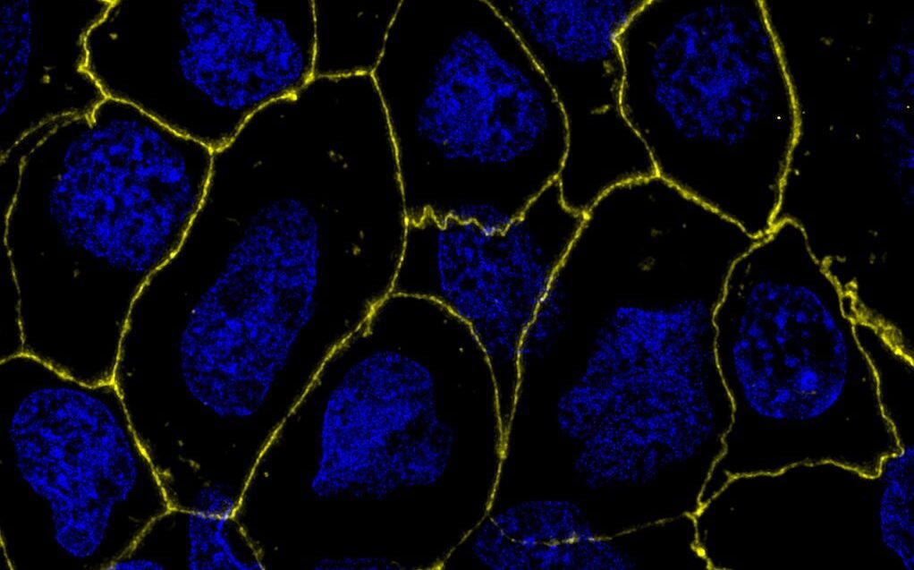 microbiota-derived-metabolite-enhances-hiv-therapy-in-monkeys