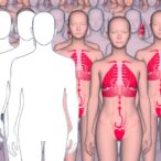 alveolar-capillary-dysplasia:-how-health-system-data-illuminate-rare-disease