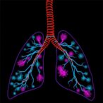 fak-splicing-variants-reveal-new-therapeutic-vulnerability-in-small-cell-lung-cancer