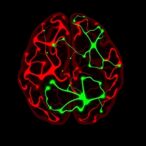 glutamate-co-release-by-inhibitory-nigral-neurons-reverses-motor-deficits-in-parkinson’s-mice