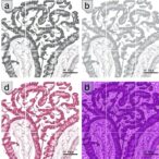 mettl14-dependent-fgf16-m6a-modification-promotes-angiogenesis-following-igfbp5-deficiency