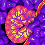 mapping-pancreatic-cancer’s-tissue-architecture-with-computational-pathology