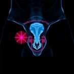 molecular-profiling-identifies-favorable-risk-pattern-in-rare,-aggressive-uterine-cancer